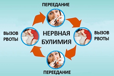 Лечение булимии в Кош-Агаче